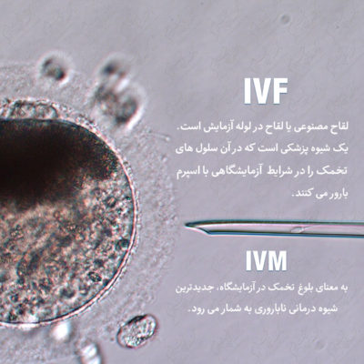 درمان ناباروری با روش IVM