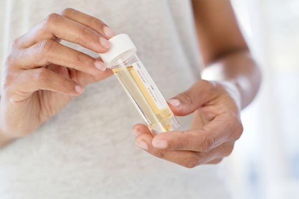 آزمایش ادرار بارداری