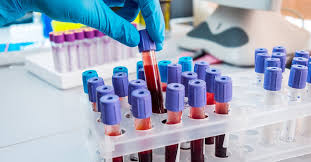آزمایش خون هورمونی در روز سوم عادت ماهانه