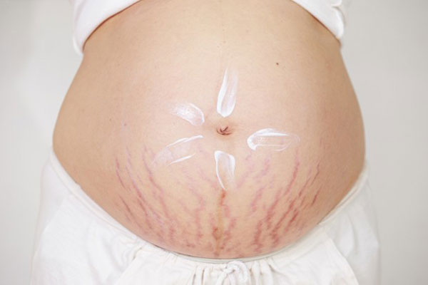 منع غذایی مادران در بارداری