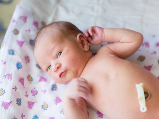 آیا بند ناف نوزاد عفونت میکنه؟