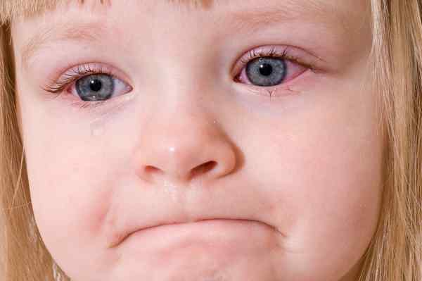 چطور عفونت چشم نوزاد رو درمان کنیم؟