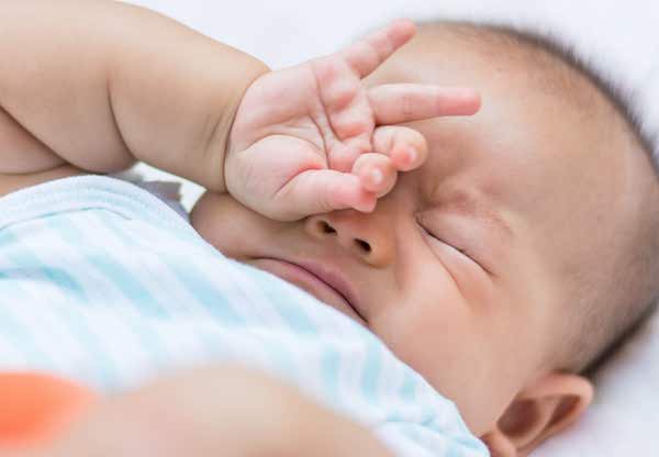 چنگ زدن صورت در نوزادان