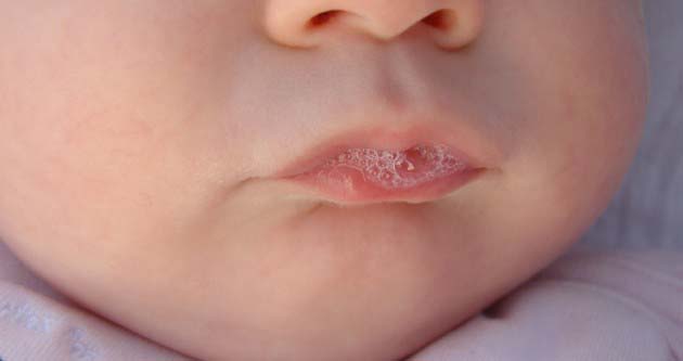 جمع شدن تف در دهان نوزاد