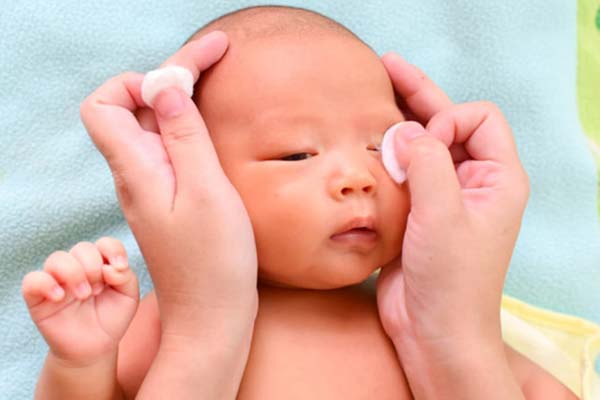 راه درمانی برای قی کردن چشم نوزاد