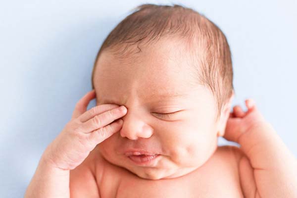 قی چشم نوزاد چه درمانی دارد؟