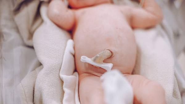 چه مراقبت هایی برای بند ناف نوزاد نیازه؟